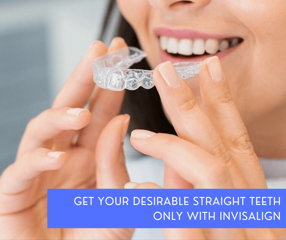 Straight Teeth Only With Invisalign