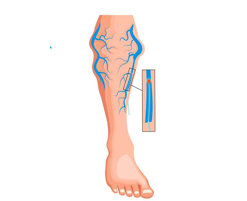 Top Tips for Athletes to Treat or Manage Knee Pain