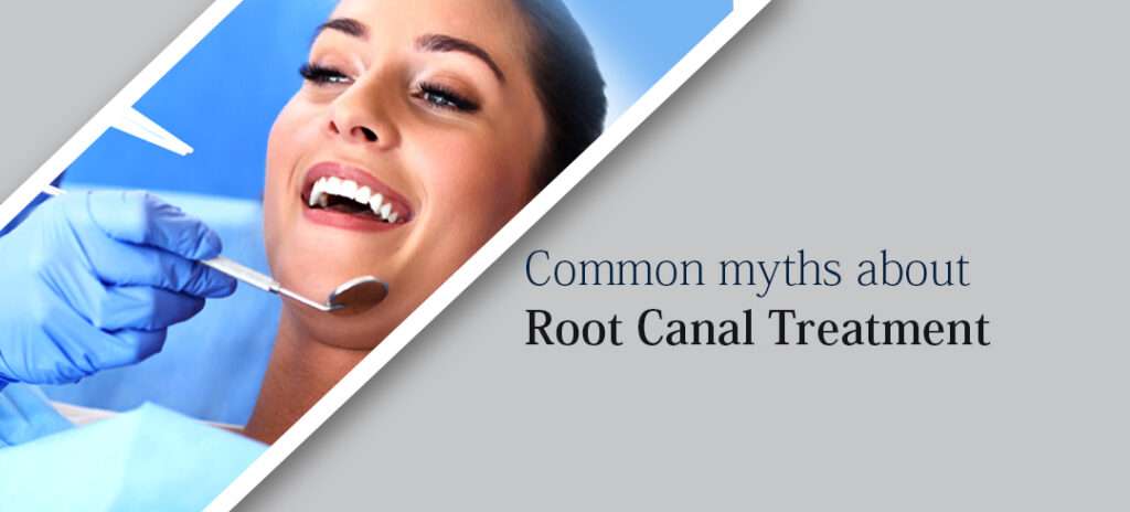 Common myths about Root Canal Treatment